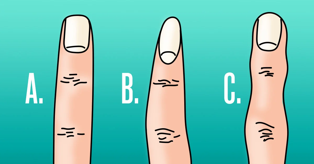 ¿Cuál es la forma de los dedos de tus manos? Tu elección te revelará el lado oculto de tu personalidad ➤ Prozoro.net.ua