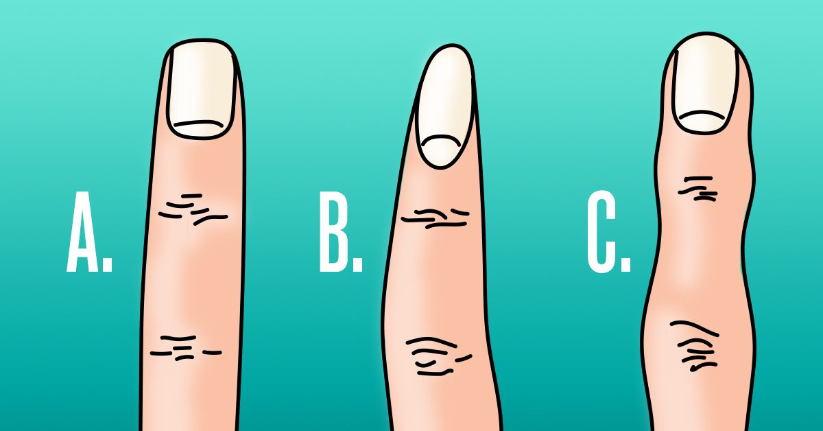 Что может рассказать о человеке форма пальца? ➤ Prozoro.net.ua