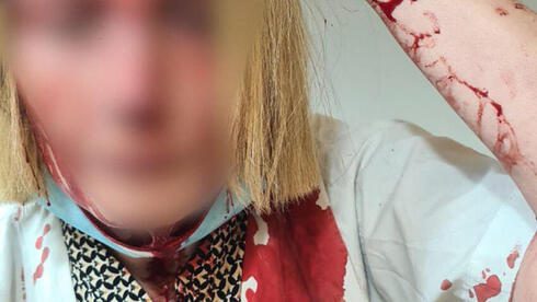 Обвинение: житель Беэр-Яакова избил врача молотком за отказ выписать риталин ➤ Prozoro.net.ua