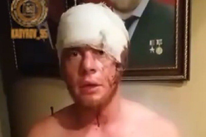 Ось що заявив полонений боєць ЗСУ в обличчя кадирівцю (відео) ➤ Prozoro.net.ua