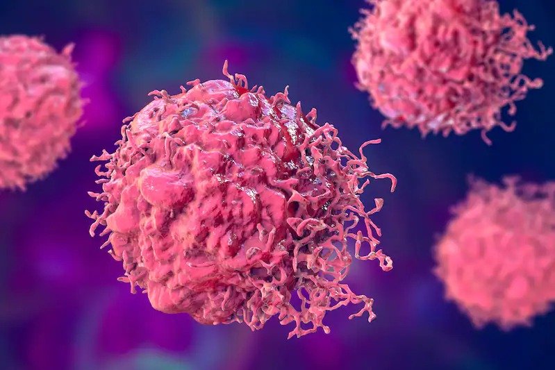 Krebs endgültig besiegt? Forscher entdecken im Tumor Substanz, die Metastasen verhindert! ➤ Prozoro.net.ua