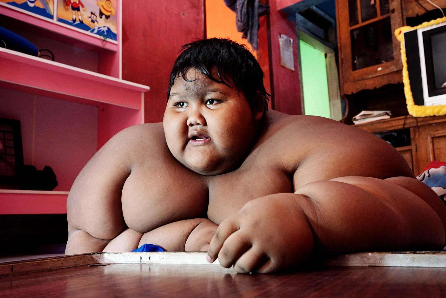 Как после похудения выглядит самый толстый мальчик в мире ➤ Infotime.co