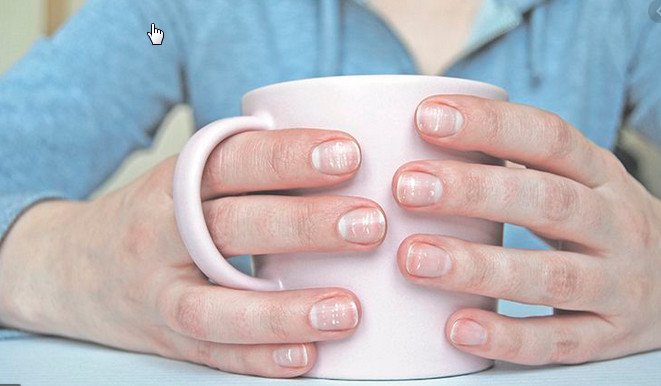 5 проблем з нігтями, які вказують на серйозні захворювання ➤ Infotime.co