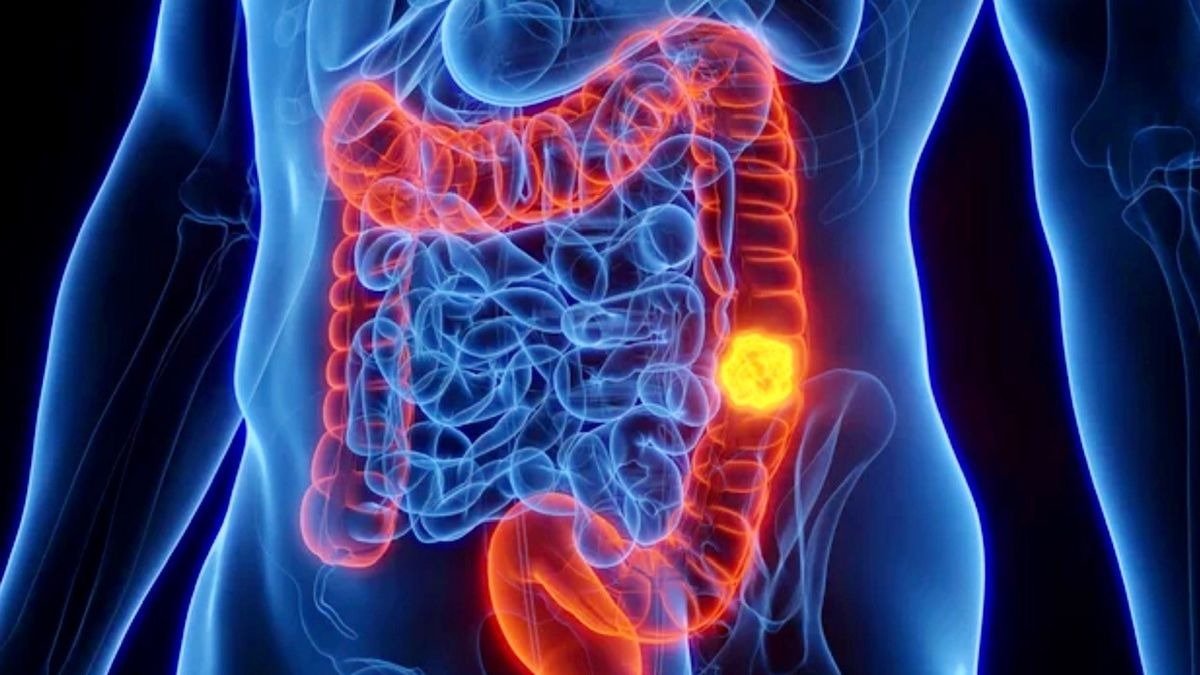 ¡No lo comas nunca! ¡Causa cáncer! Lo comemos todos los días