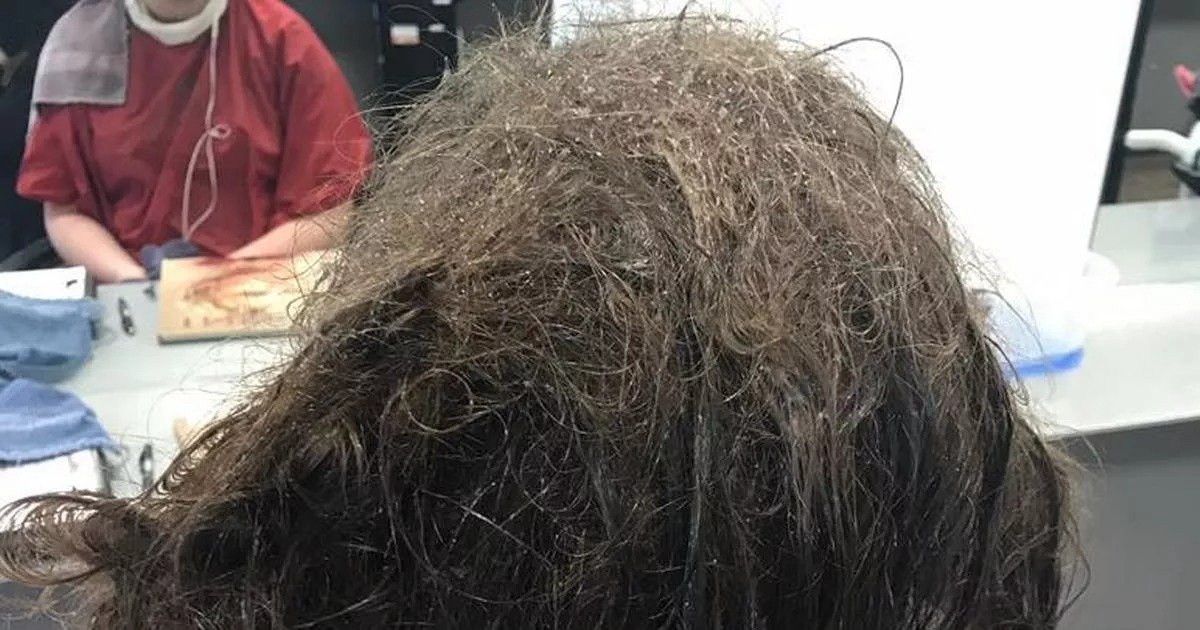 Penata Rambut Memotong Rambut Remaja dan Menemukan Ini di Dalamnya ➤ Infotime.co