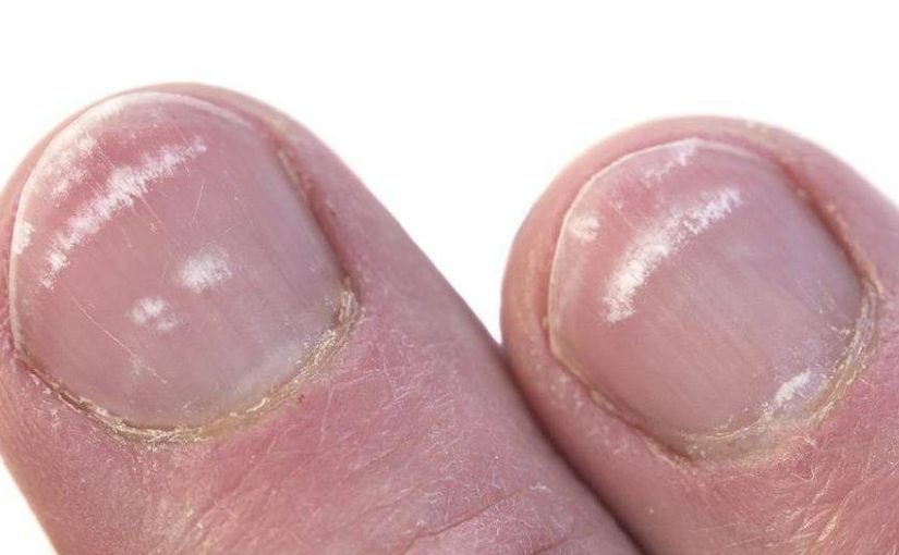 Was Ihre Nagelwachstumsrate über Ihre Lebensdauer verraten könnte ➤ Infotime.co