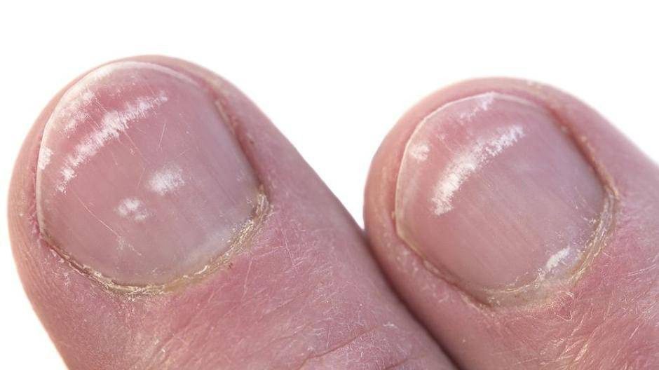 Was Ihre Nagelwachstumsrate über Ihre Lebensdauer verraten könnte ➤ Infotime.co