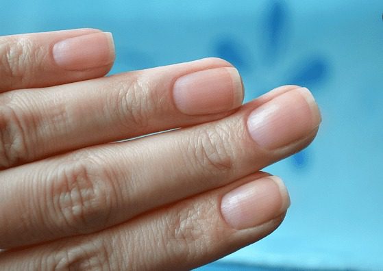 Lúnulas: sinais discretos que podem indicar problemas de saúde