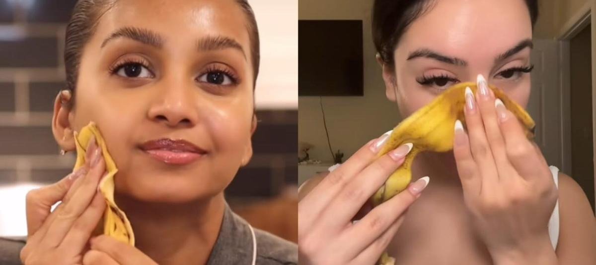 Eine Frau legt eine Bananenschale auf ihren Arm. Du wirst nicht glauben, was dann passierte!