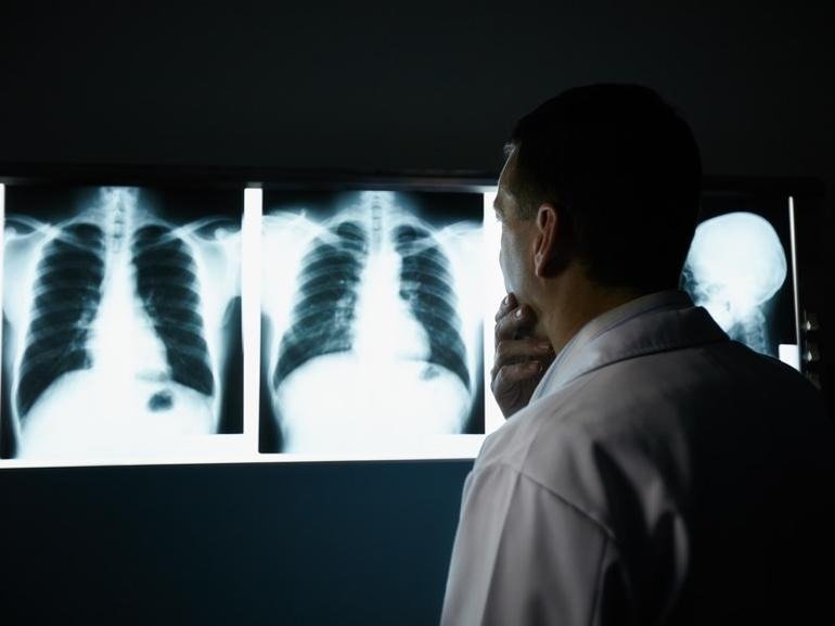 Un hombre acude a una revisión de rutina. El médico mira la radiografía y dice: “Lo siento”