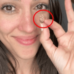 Жінка 35 років жила з липкою стрічкою в носі, не знаючи про це ➤ Infotime.co