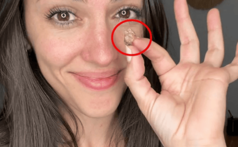 Жінка 35 років жила з липкою стрічкою в носі, не знаючи про це ➤ Infotime.co