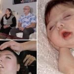 Жінка без мозку відсвяткувала новий день народження: їй не давали шансів на життя (фото) ➤ Infotime.co