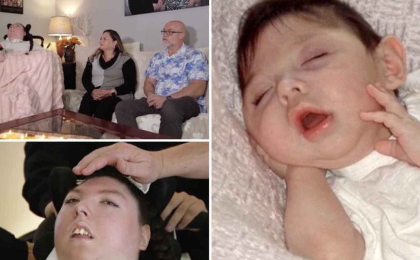 Жінка без мозку відсвяткувала новий день народження: їй не давали шансів на життя (фото) ➤ Infotime.co