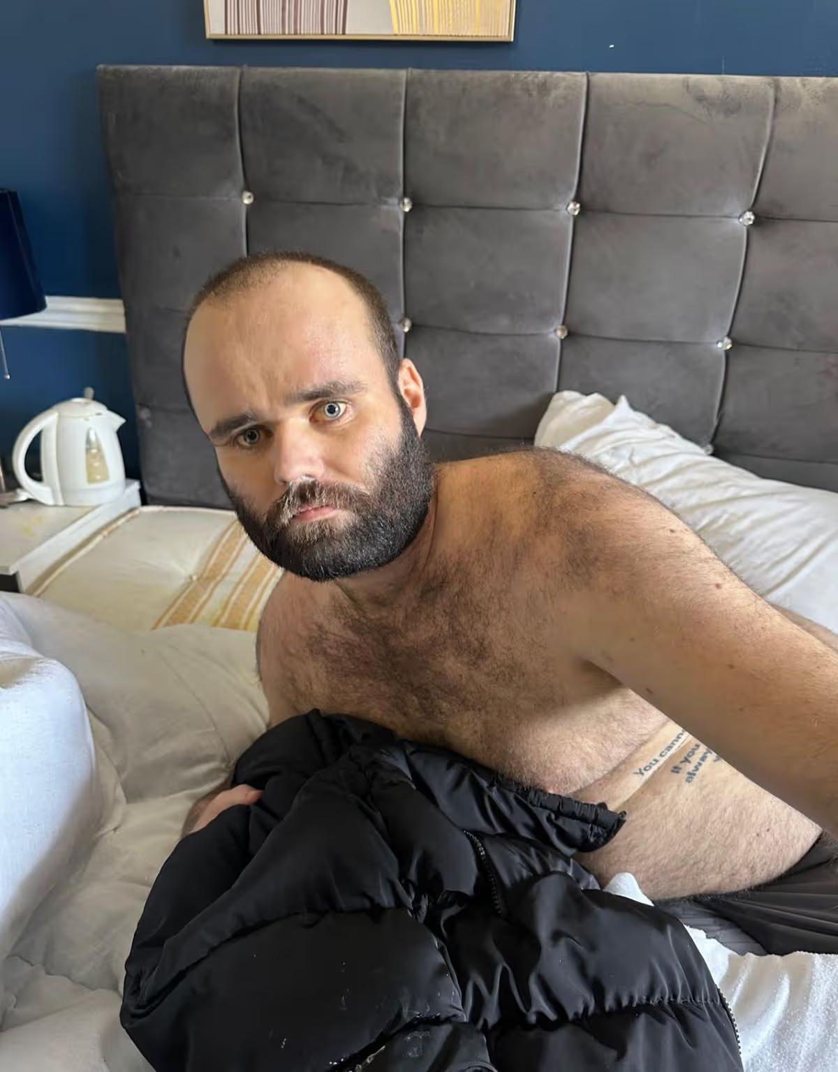 Чоловік щодня пив горілку і запивав шістьма пляшками вина: як це його змінило