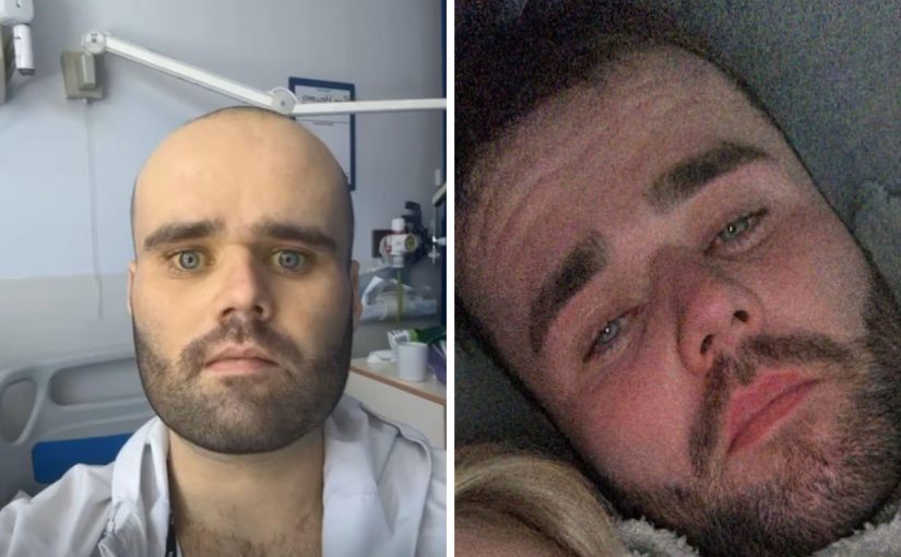 Чоловік щодня пив горілку і запивав шістьма пляшками вина: як це його змінило ➤ Infotime.co