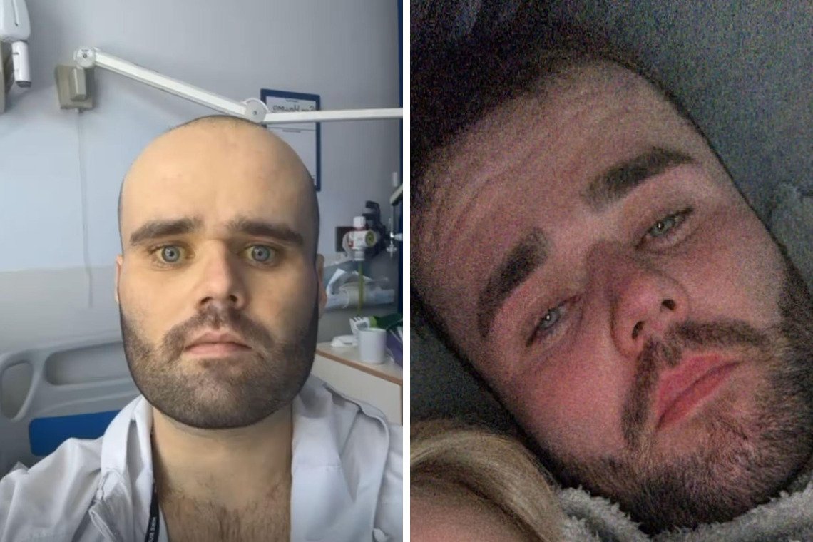 Чоловік щодня пив горілку і запивав шістьма пляшками вина: як це його змінило ➤ Infotime.co