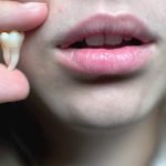 Чому зуби мудрості з’являються не в кожного ➤ Infotime.co