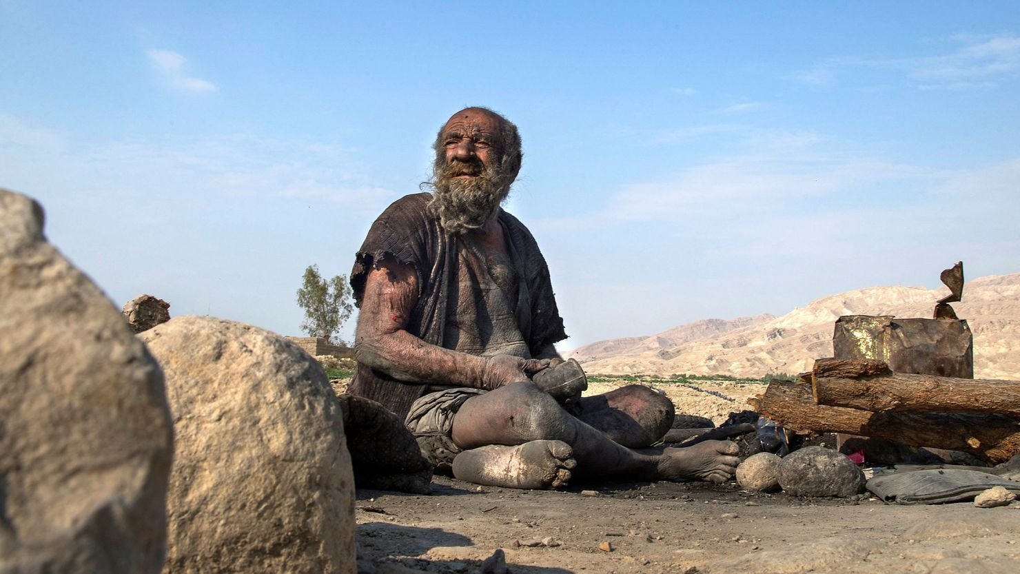 Igitt! Dieser Mann hat sich seit 65 Jahren nicht mehr gewaschen!