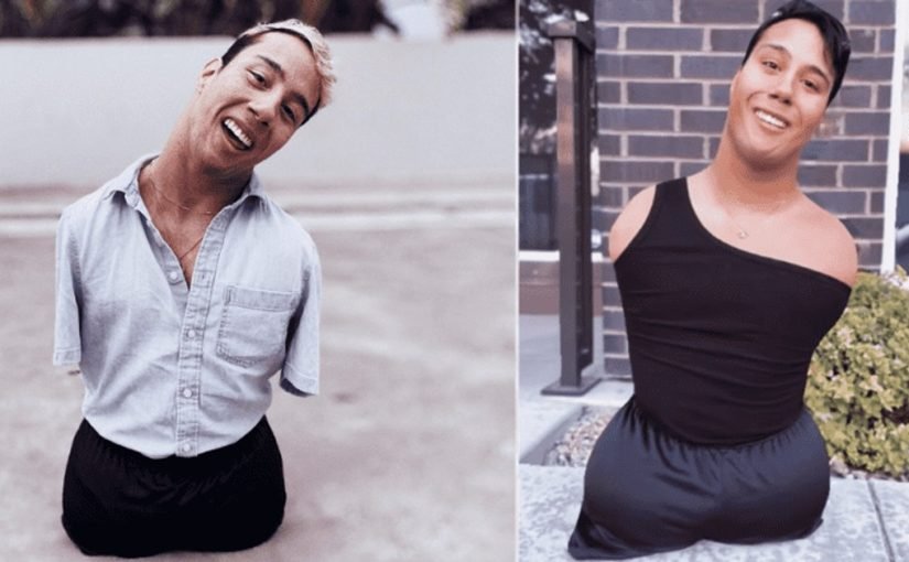 Un hombre sin brazos ni piernas, abandonado de bebé, inspira a millones con sus videos de maquillaje ➤ Infotime.co