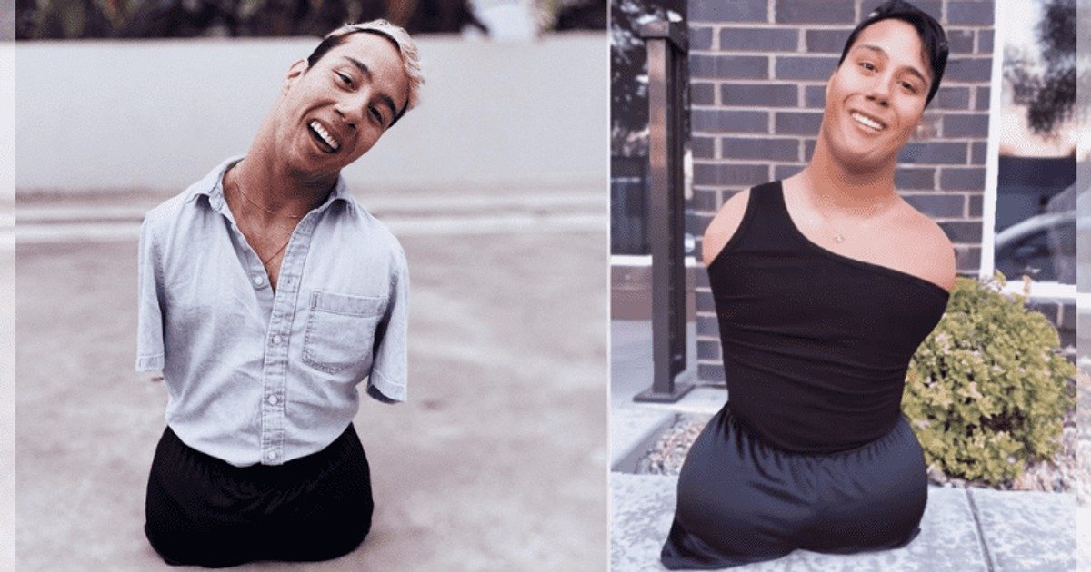 Un hombre sin brazos ni piernas, abandonado de bebé, inspira a millones con sus videos de maquillaje ➤ Infotime.co