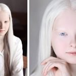 Los rasgos genéticos humanos más raros y su probabilidad ➤ Infotime.co