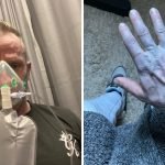 Проснулся синим: британец испугал врачей странной «болезнью» (фото) ➤ Infotime.co