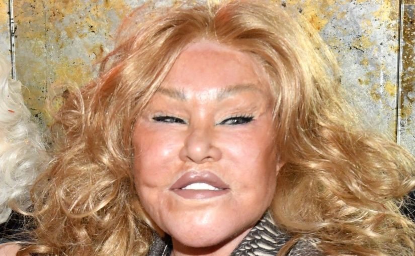 Prominente, deren Schönheitsoperationen für Aufsehen sorgten: Was Experten sagen ➤ Infotime.co