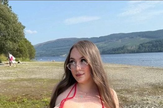 Жінка з “найбільшими грудьми” розповіла про життя з такою особливістю (фото)