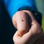 Лісники назвали простий спосіб захисту від кліщів під час прогулянок ➤ Infotime.co