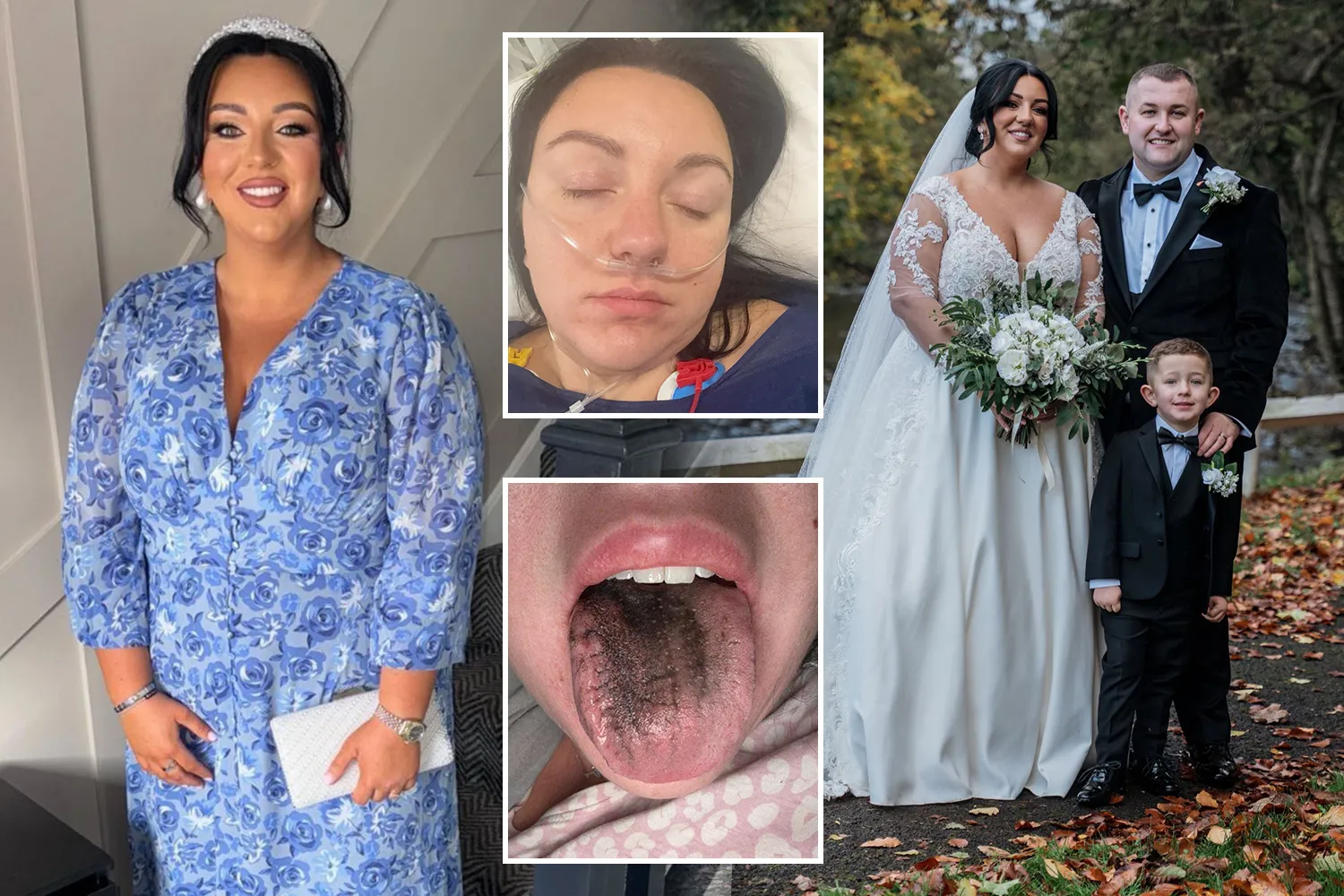 После уколов для похудения у женщины почернел язык (фото) ➤ Главное.net